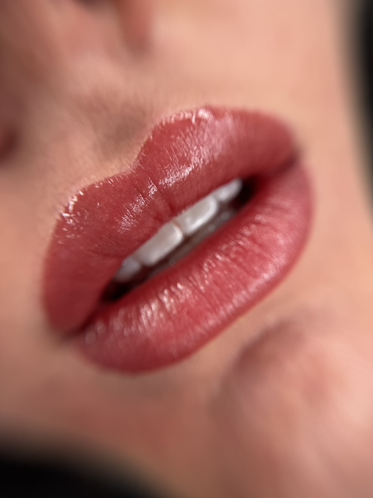 Full lips